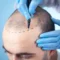 Preparing for Hair Transplant in Turkey - Lerra Clinic