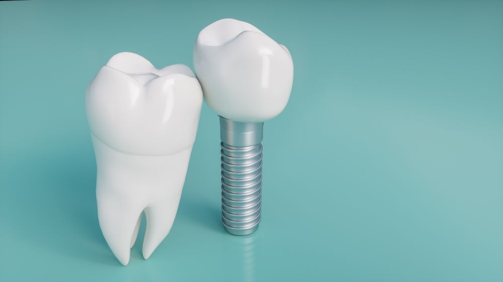 Dental implants in Istanbul Turkey 1