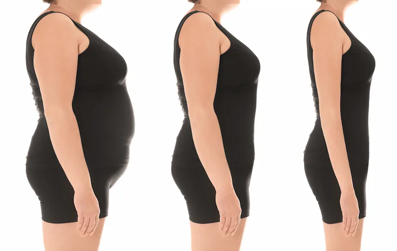 How Much Weight Loss After Liposuction?