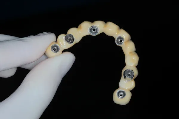 fix teeth in turkey