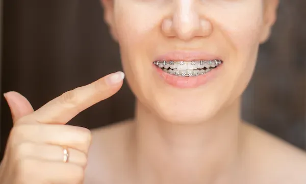fix teeth in turkey