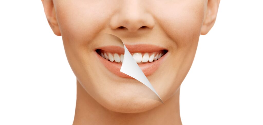 Top Dental Cosmetic Procedures