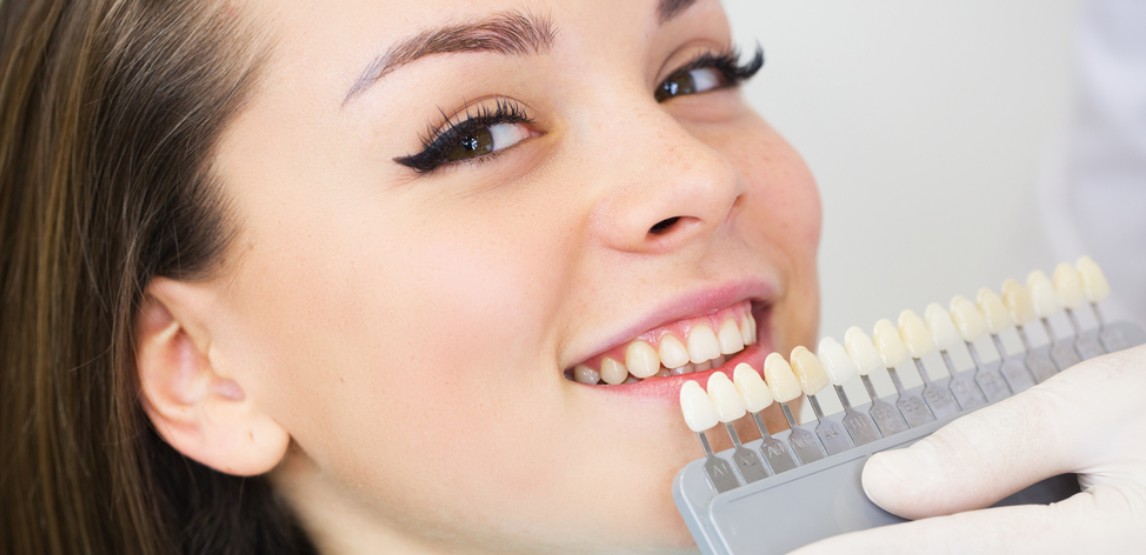 Top Dental Cosmetic Procedures