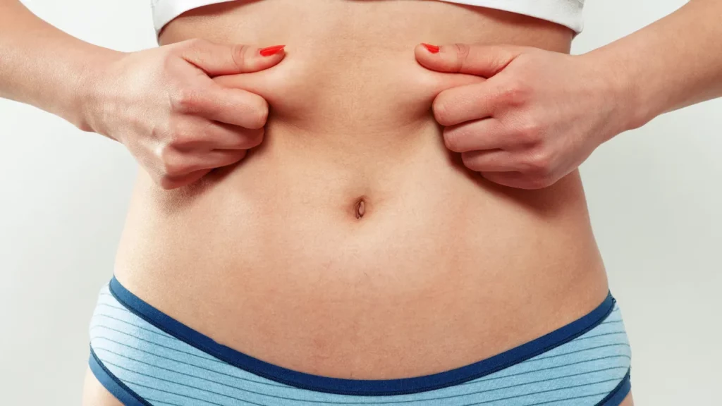 Abdominal Hardening After Liposuction