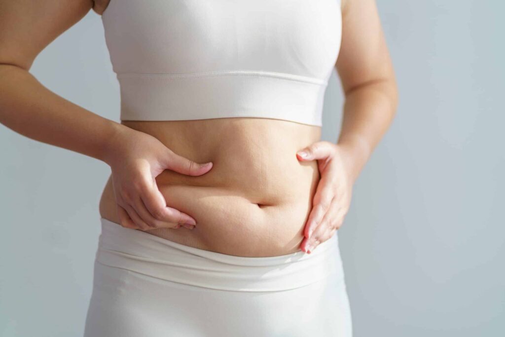 Abdominal Hardening After Liposuction