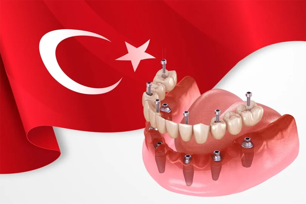 Affordable Dental Implants in Turkey