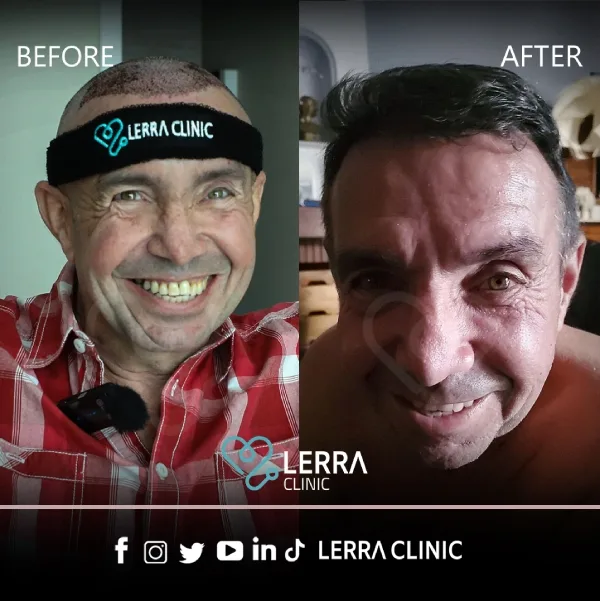 Before and After - Hair