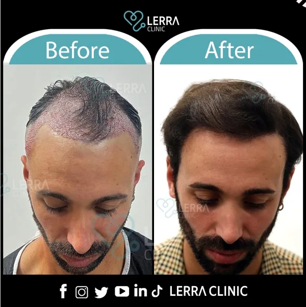 Before and After - Hair