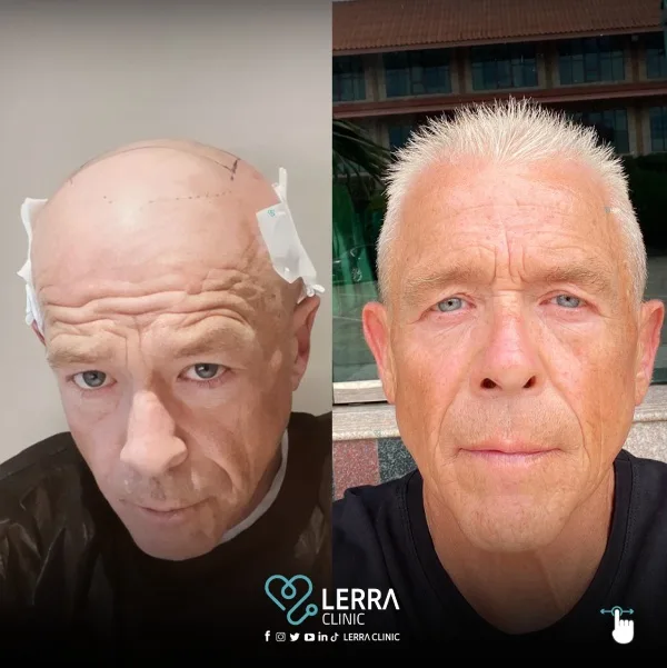 Before and After - Hair
