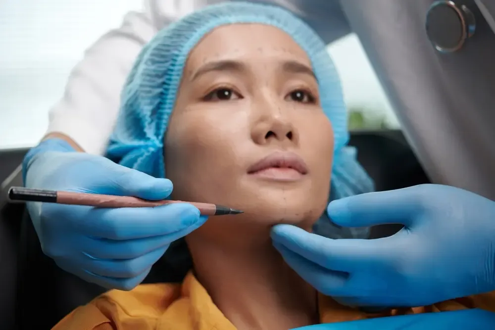 Chin Implant