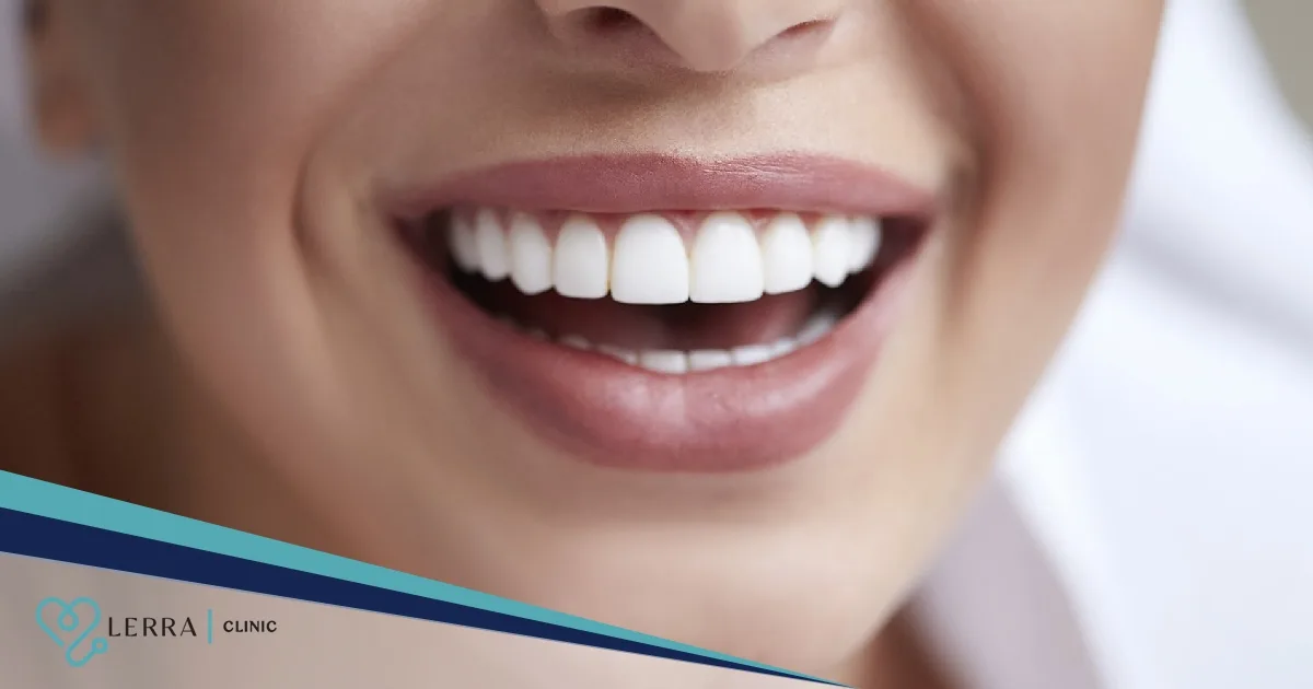 Affordable Turkish Crowns