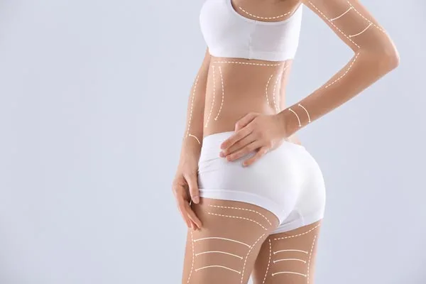 How Stars Use Liposuction and Body Sculpting to Stay in Shape