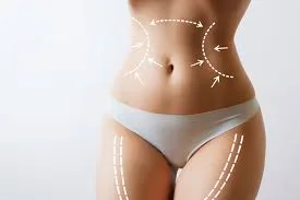 How Stars Use Liposuction and Body Sculpting to Stay in Shape