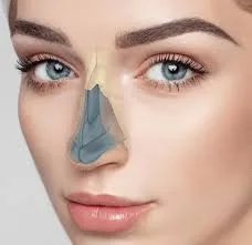 كيف يعزز تجميل الأنف تناسق الوج