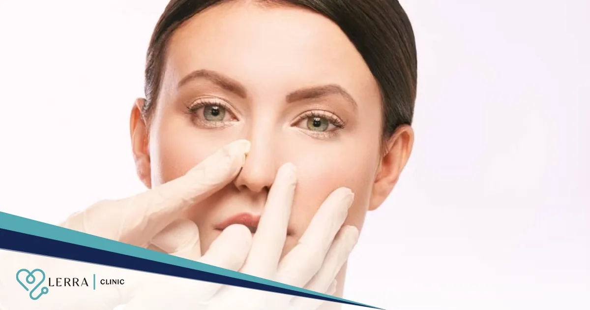 Rhinoplasty for Nasal Blockage