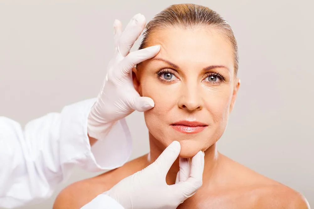 Facelift surgery