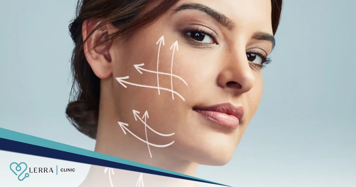 Facelift surgery