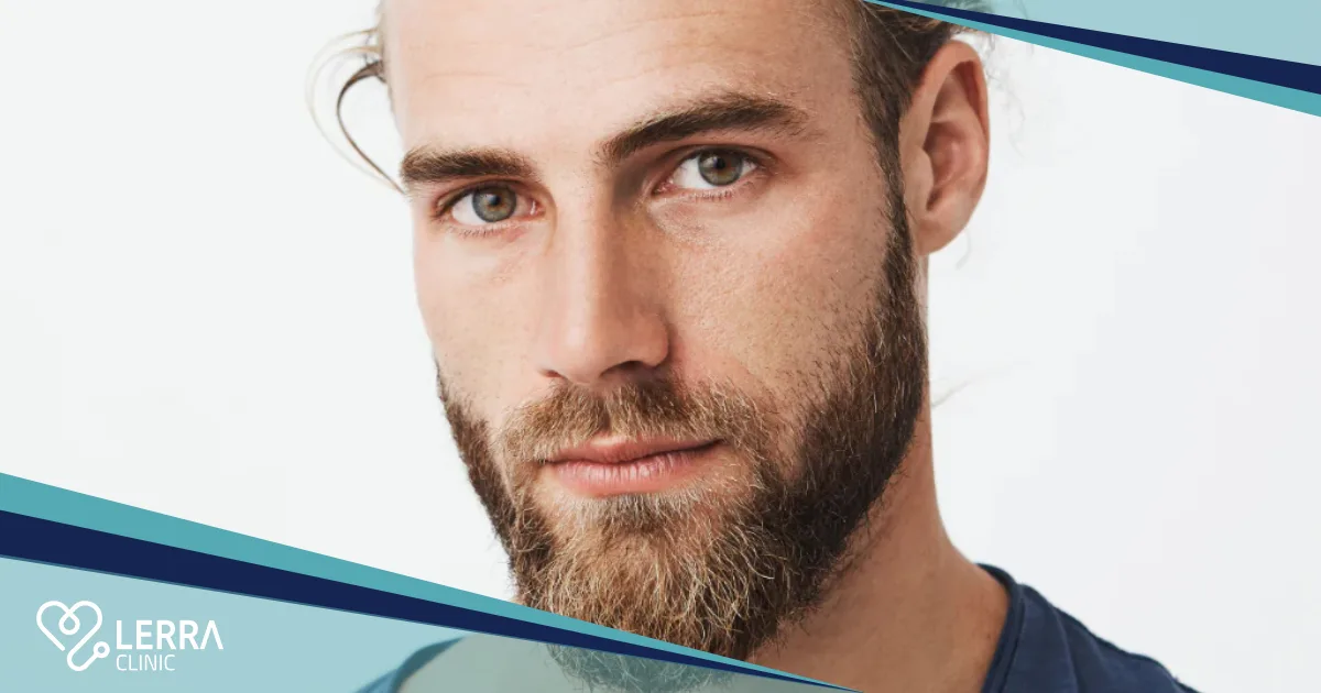 a Full Well-Defined Beard