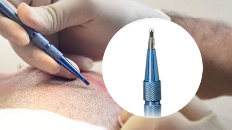 فوائد زراعة الشعر بتقنية السفير في عام 2025