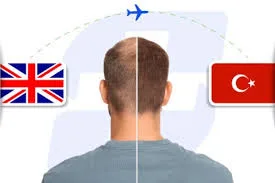 Hair Transplant Costs in the UK vs. Turkey