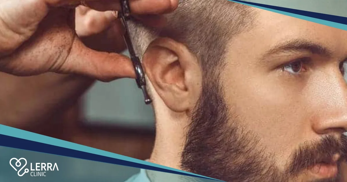 hairstyle after hair transplant