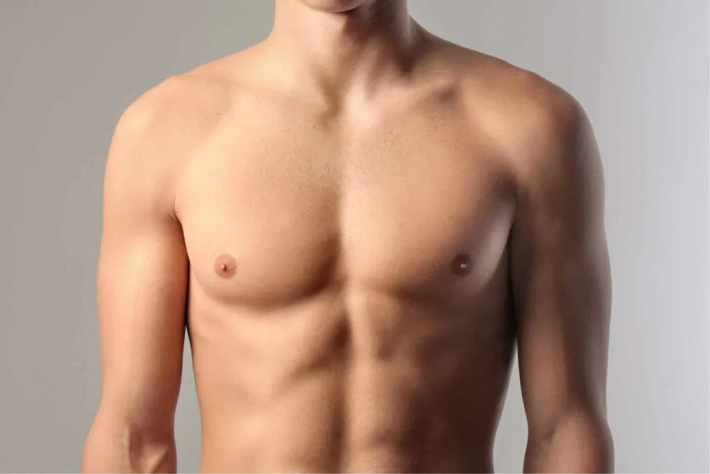 Gynecomastia