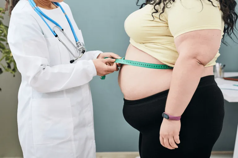Chirurgie de la sleeve gastrectomie