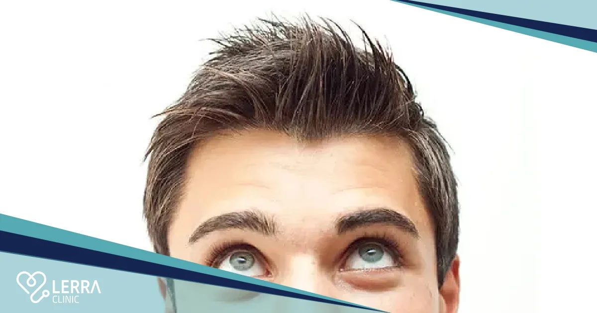 hair transplant Cost in Turkey 2025