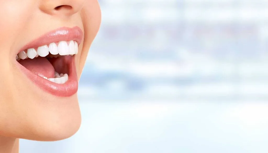 Hollywood smile