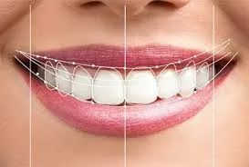 NEW TEETH IN TURKEY