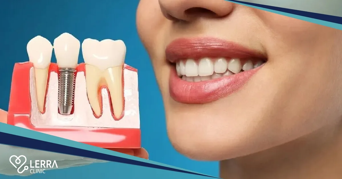 NEW TEETH IN TURKEY