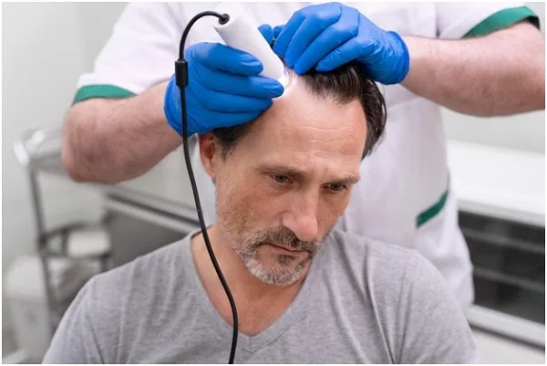 Preparing for a Hair Transplant