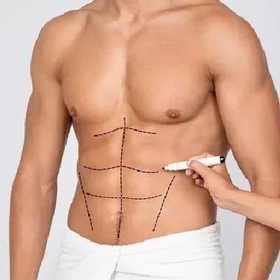 عملية تجميل الجسم