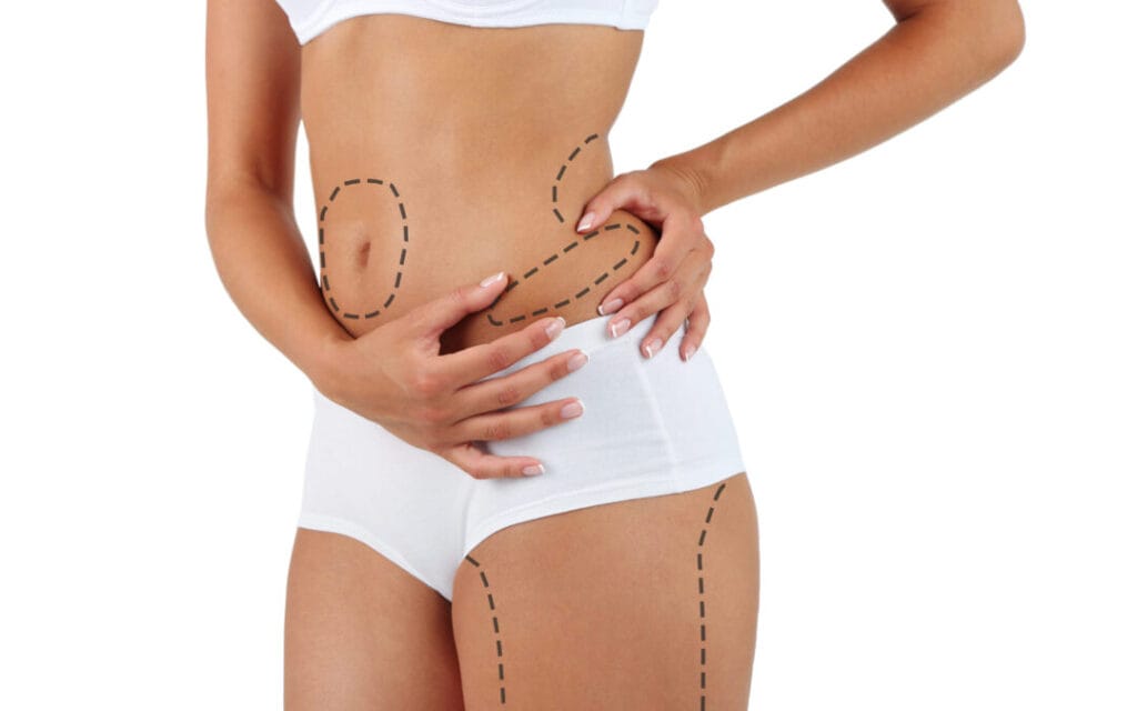 Top 10 Popular Surgeries in 2025