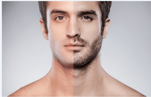 Body Hair Transplant in Turkey