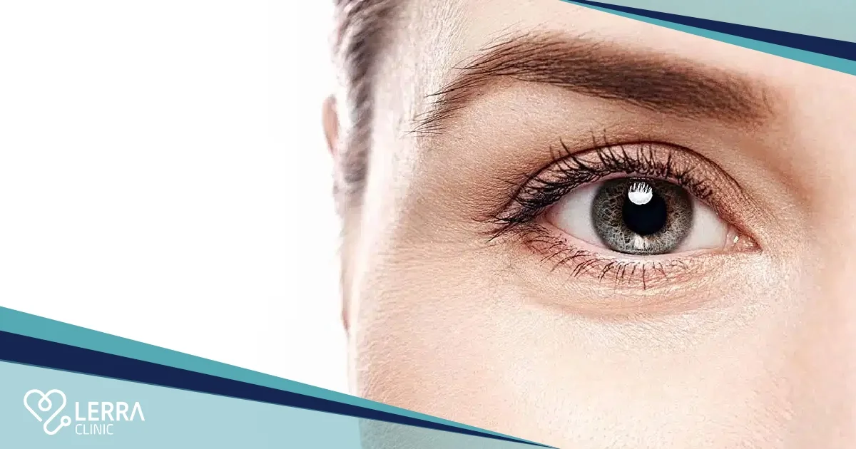 brow lift vs eyelid surgery