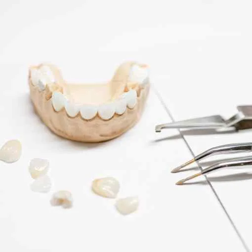 Dental Veneers and Lumineers