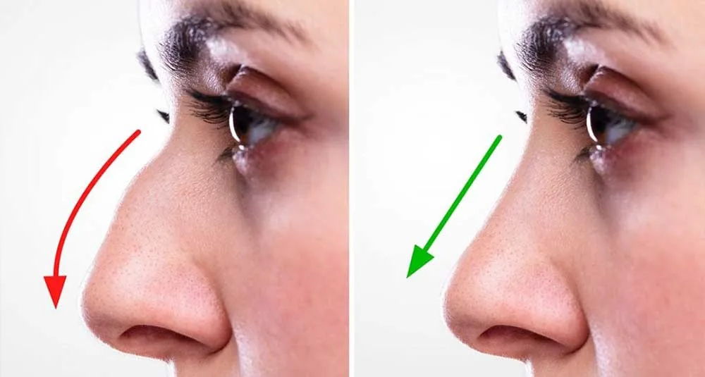 أفضل مراجعات جراحة التجميل في تركيا