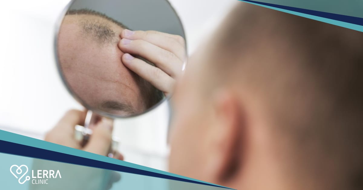 hair transplant process