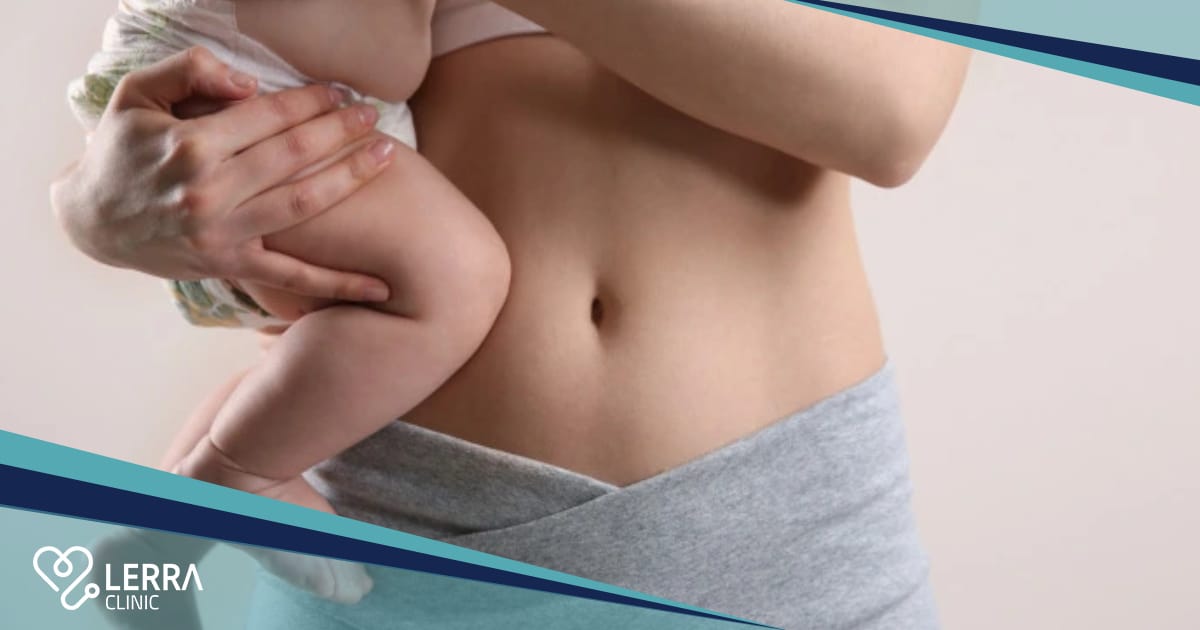 Mommy Makeover in Turkey