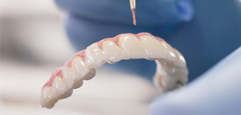 زراعة الأسنان الوجنية