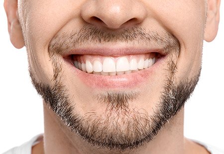Hollywood Smile for Men 