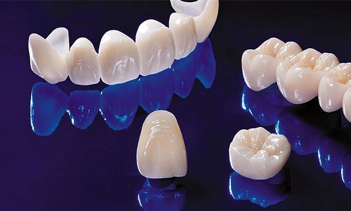 تيجان الزيركون أم تيجان الإيماكس