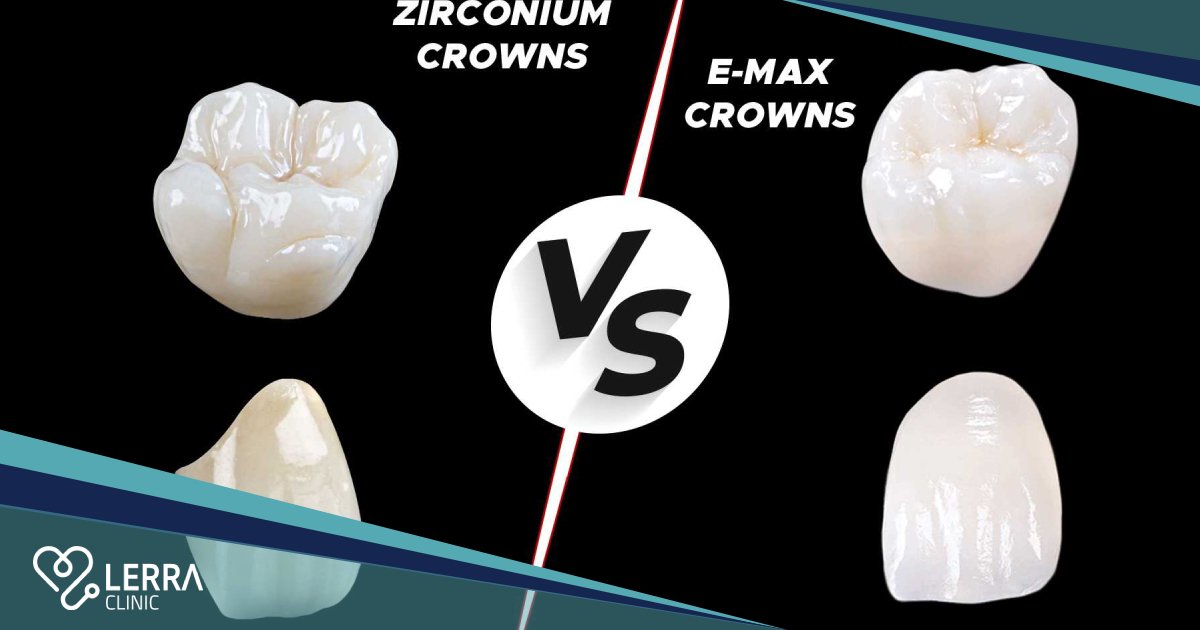 تيجان الزيركون أم تيجان الإيماكس