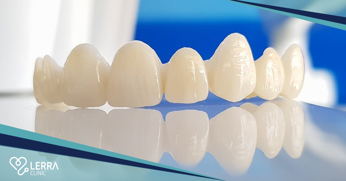 Zirconium Crowns Turkey