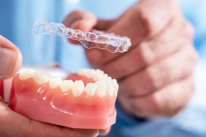 Invisalign Clear Aligners in Turkey