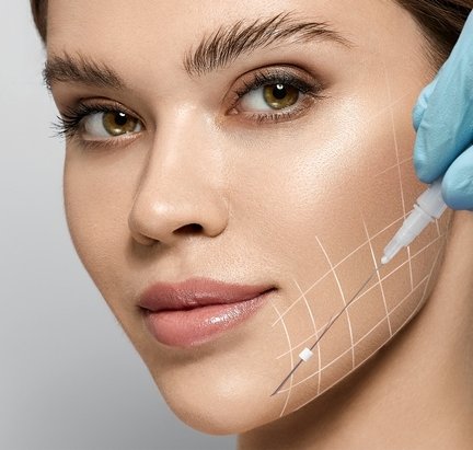 Gold Thread Face Lift