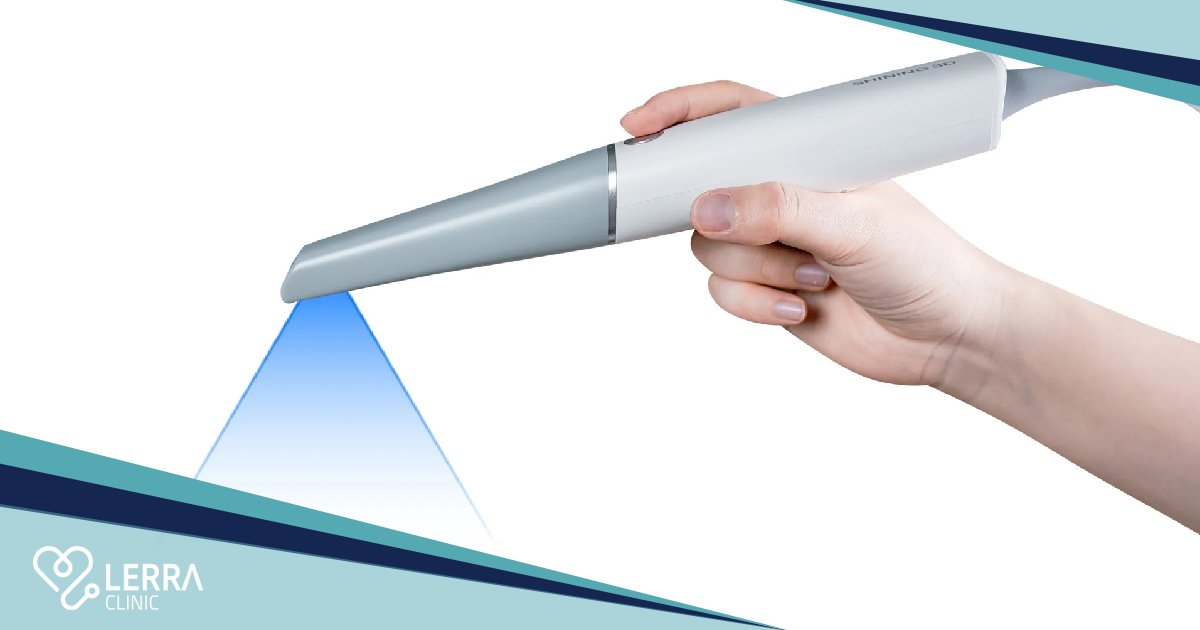 3D Intraoral Scanner in Turkey