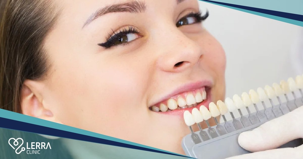 Top Dental Cosmetic Procedures